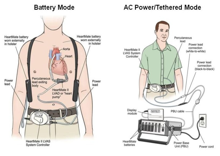 PP1 Fig 1